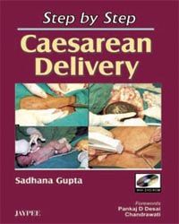 STEP BY STEP CAESAREAN DELIVERY WITH DVD ROM 2007